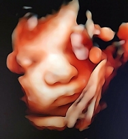 4 Boyutlu Ultrason, Doğuma Yakın