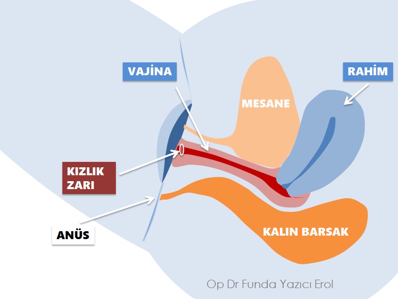 Kızlık Zarı Muayenesi