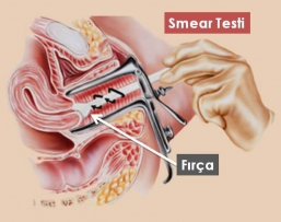 Smear Testi