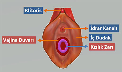 kızlık zarı muayenesi