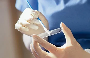 HPV Testinin Pozitif Çıkması