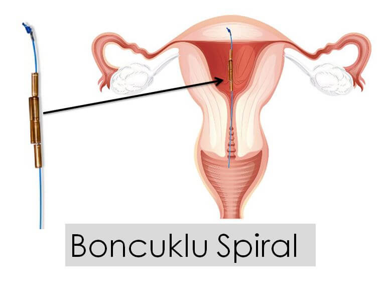 Boncuklu Spiral