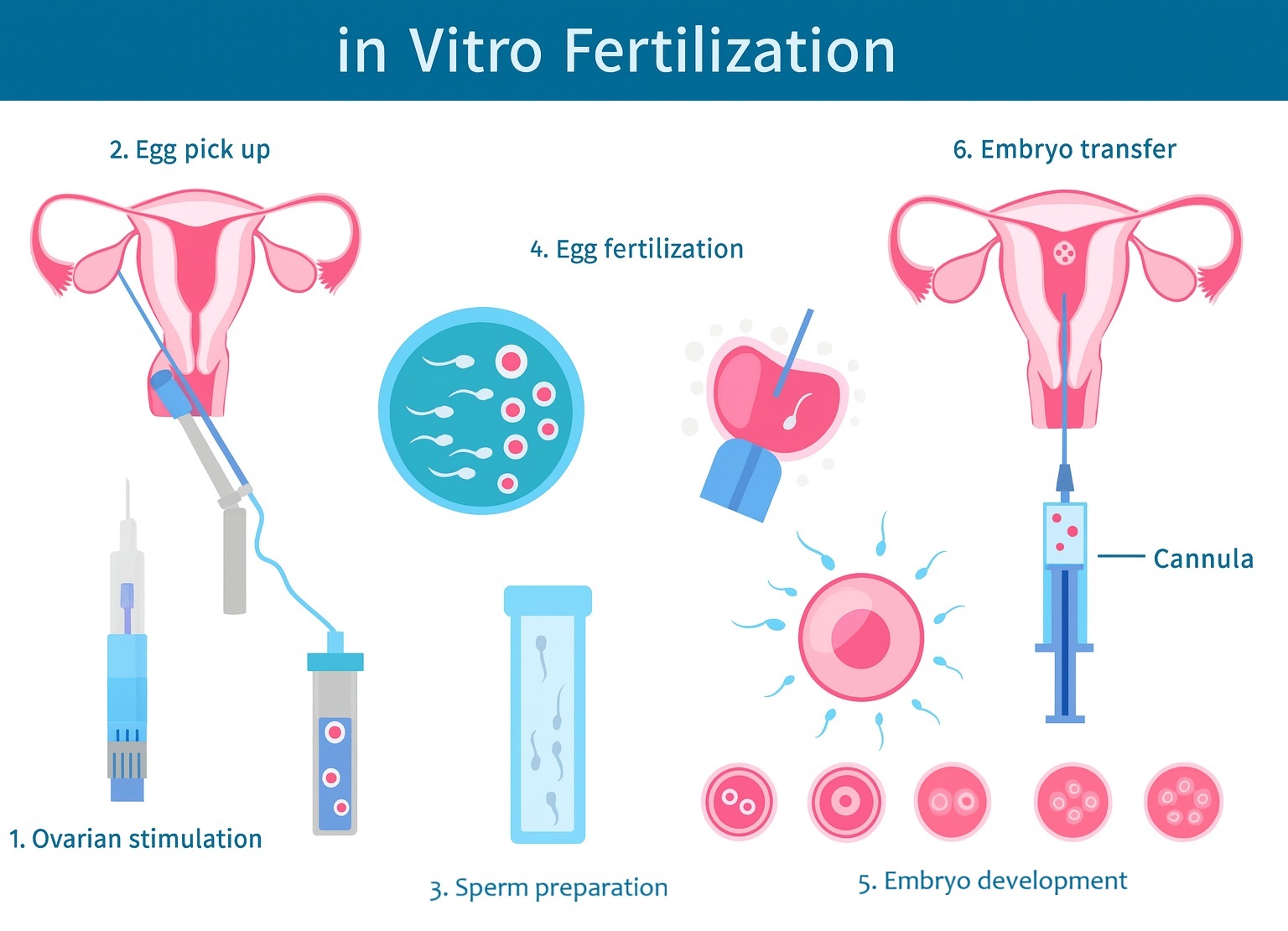 IVF Treatment in Turkey