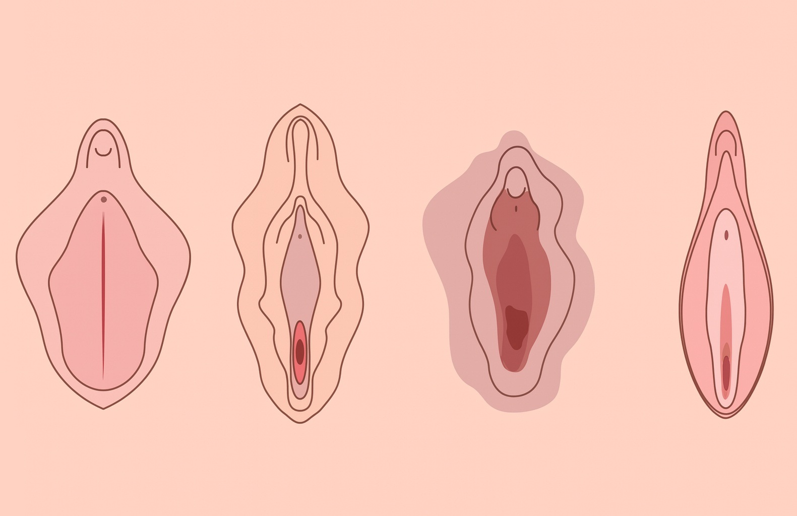Labiaplasty Turkey