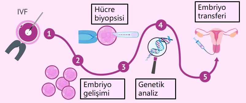 Preimplantasyon Genetik Tanı
