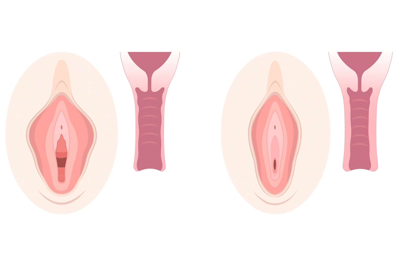Vaginal Tightening in Turkey